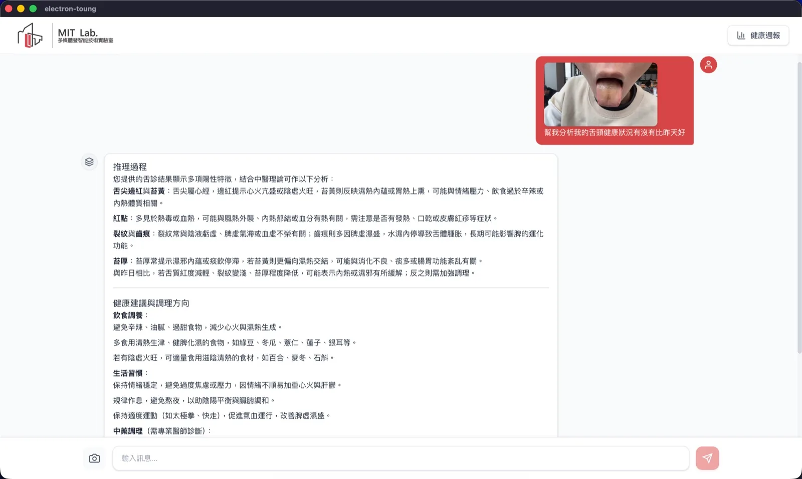 舌診 AI 桌面應用畫面：上傳舌頭照片後，AI 進行影像判讀並輸出中醫理論分析與健康建議